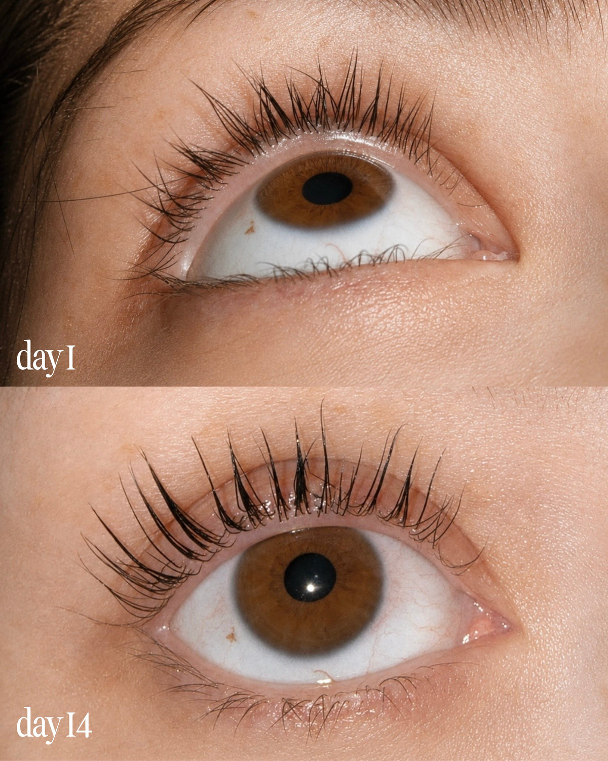 Before and after