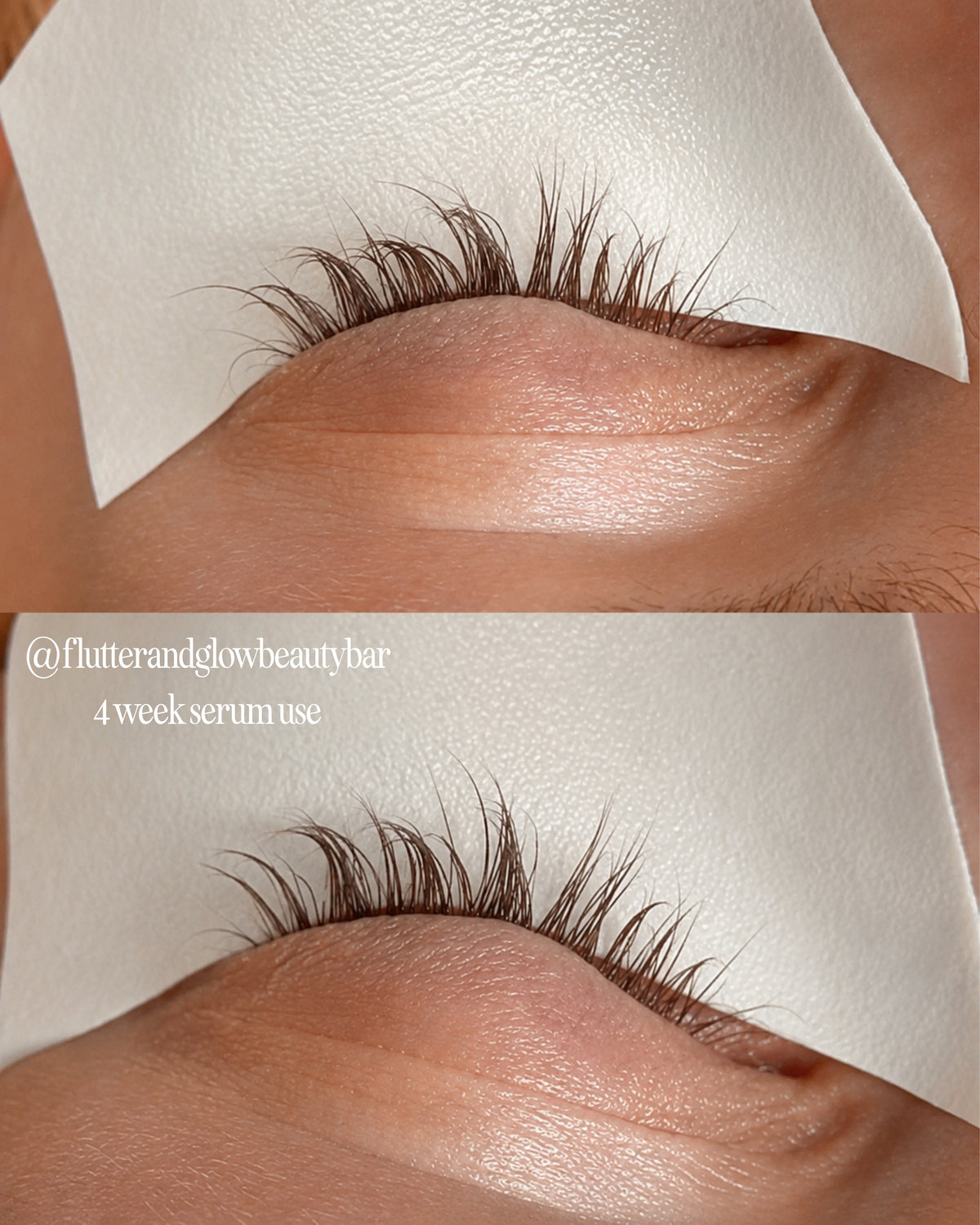 Before and after