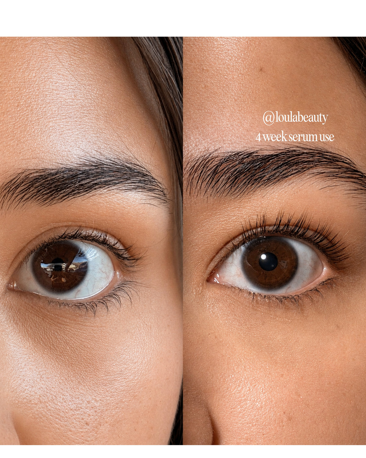 Before and after