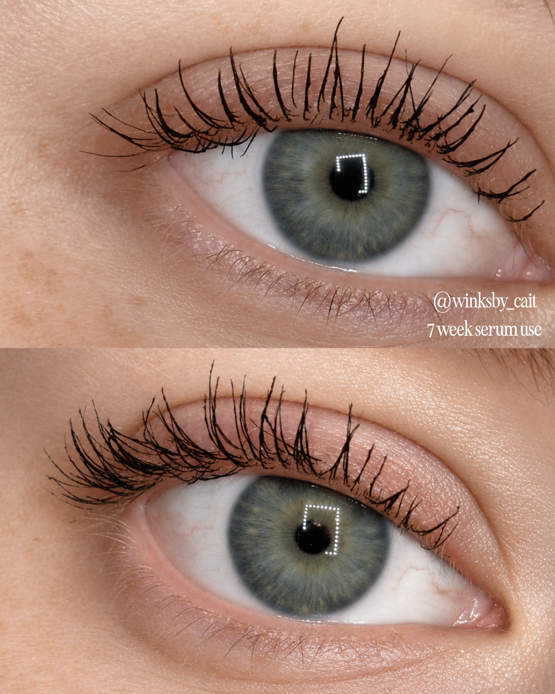 Before and after