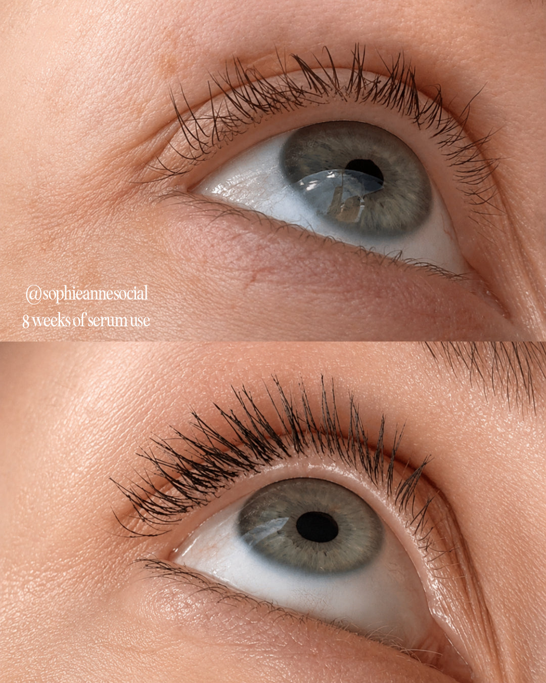 Before and after