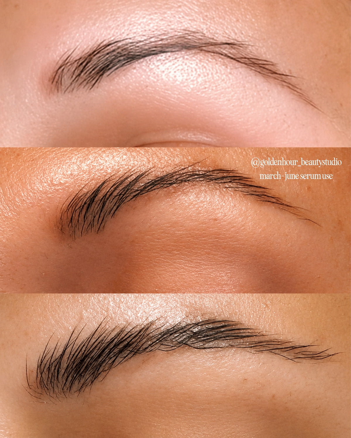 Before and after